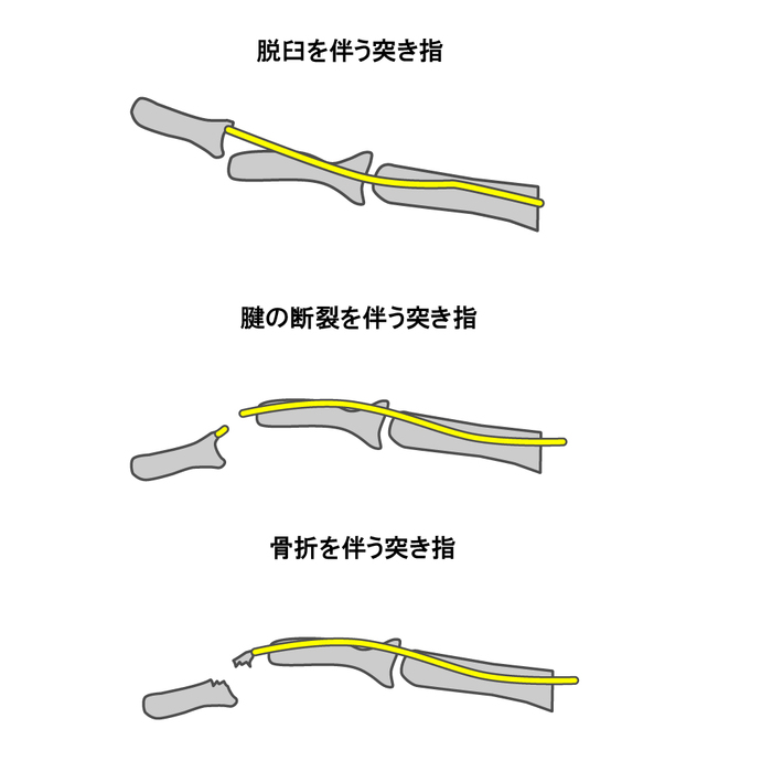 画像503
