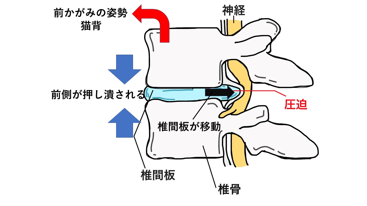 ダウンロード (3)