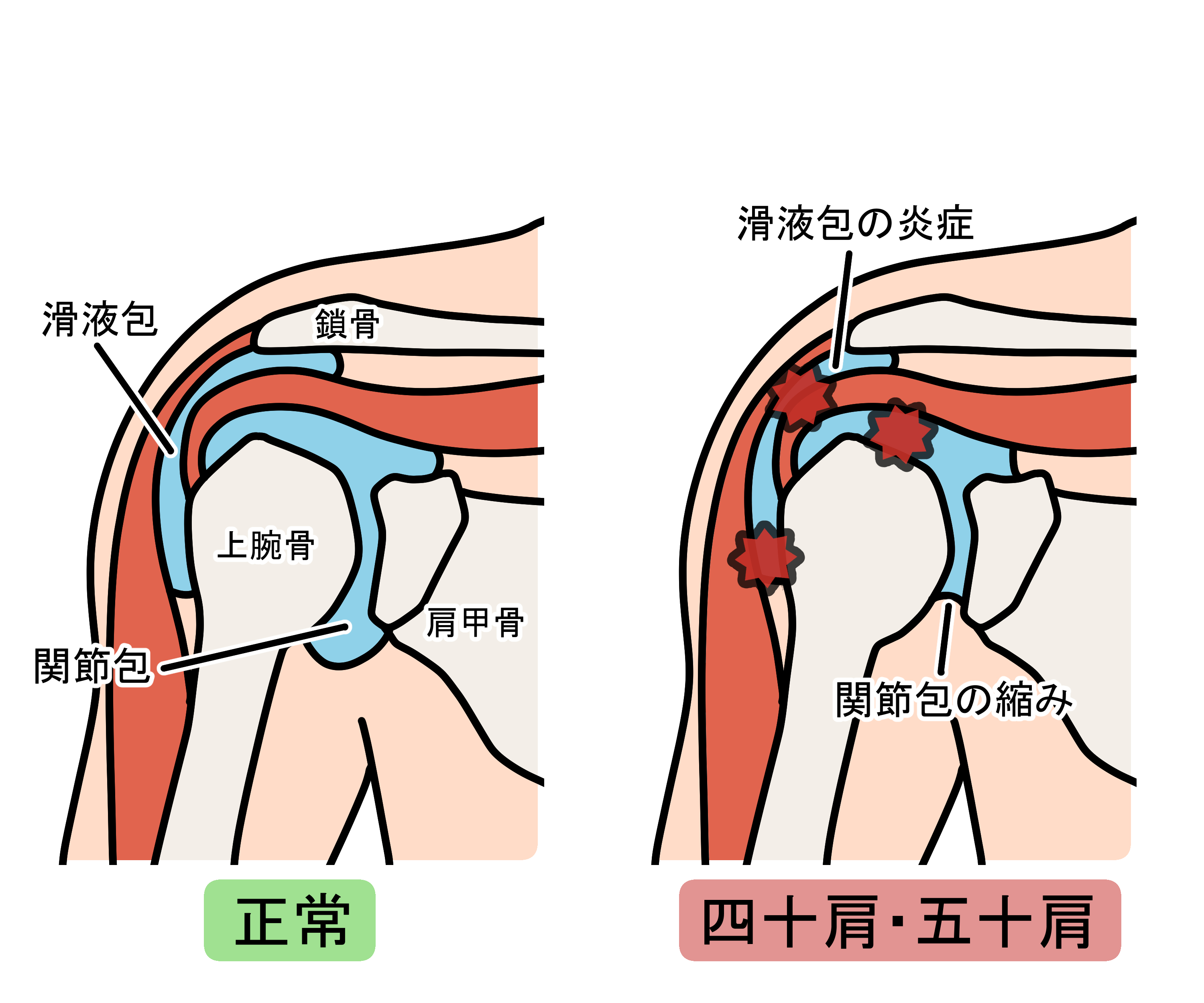 ダウンロード (3)